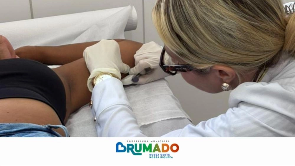 Saúde da mulher ganha reforço em Brumado com implante contraceptivo de longa duração nas UBS